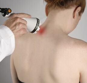 La terapia con láser ayudará a aliviar la inflamación y activar la regeneración de tejidos en el cuello. 