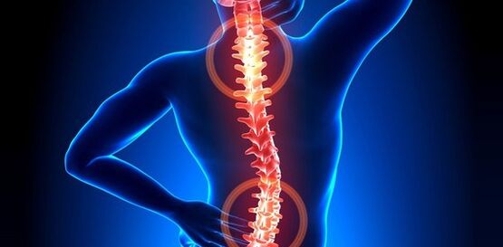 síntomas de dolor de espalda