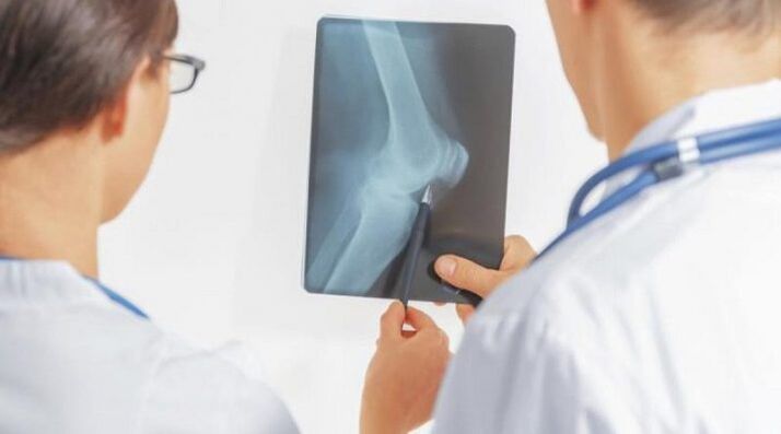 Después del diagnóstico necesario de artrosis de la articulación de la rodilla, los médicos prescriben un tratamiento complejo. 