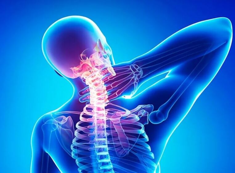Osteocondrosis de la columna cervical
