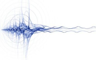 Microvibración