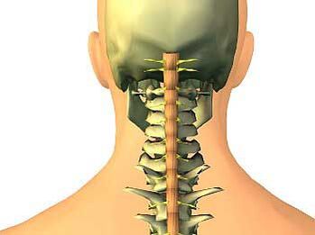 Osteocondrosis de la región cervical